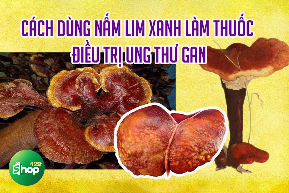 giá nấm lim xanh